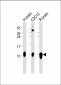 S100B Antibody